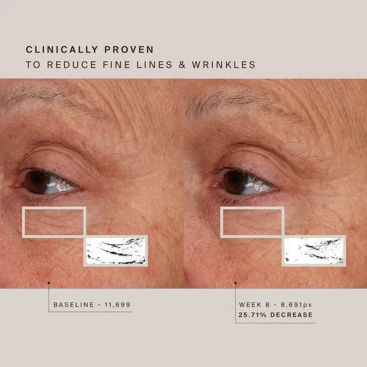 Red Light Face Mask Wellness HigherDose higherdose-wellness-red-light-face-mask-1157603499