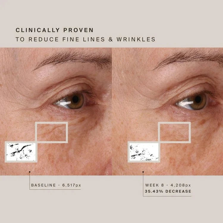 Red Light Face Mask Wellness HigherDose higherdose-wellness-red-light-face-mask-1157603503