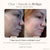 Project E Beauty Skin Care Faisca Neon & Argon | High Frequency Wand