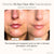 Project E Beauty Skin Care Faisca Neon & Argon | High Frequency Wand