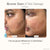 Project E Beauty Skin Care Lumamask Pro | LED Light Therapy Face Mask