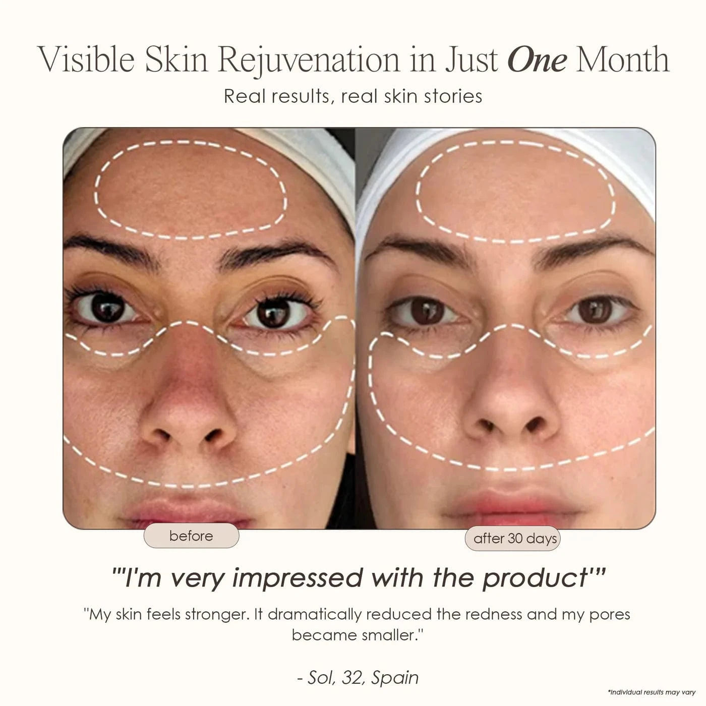 Project E Beauty Skin Care Lumamask Pro | LED Light Therapy Face Mask