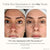 Project E Beauty Skin Care Lumamask Pro | LED Light Therapy Face Mask