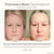 Project E Beauty Skin Care Lumamask Pro | LED Light Therapy Face Mask
