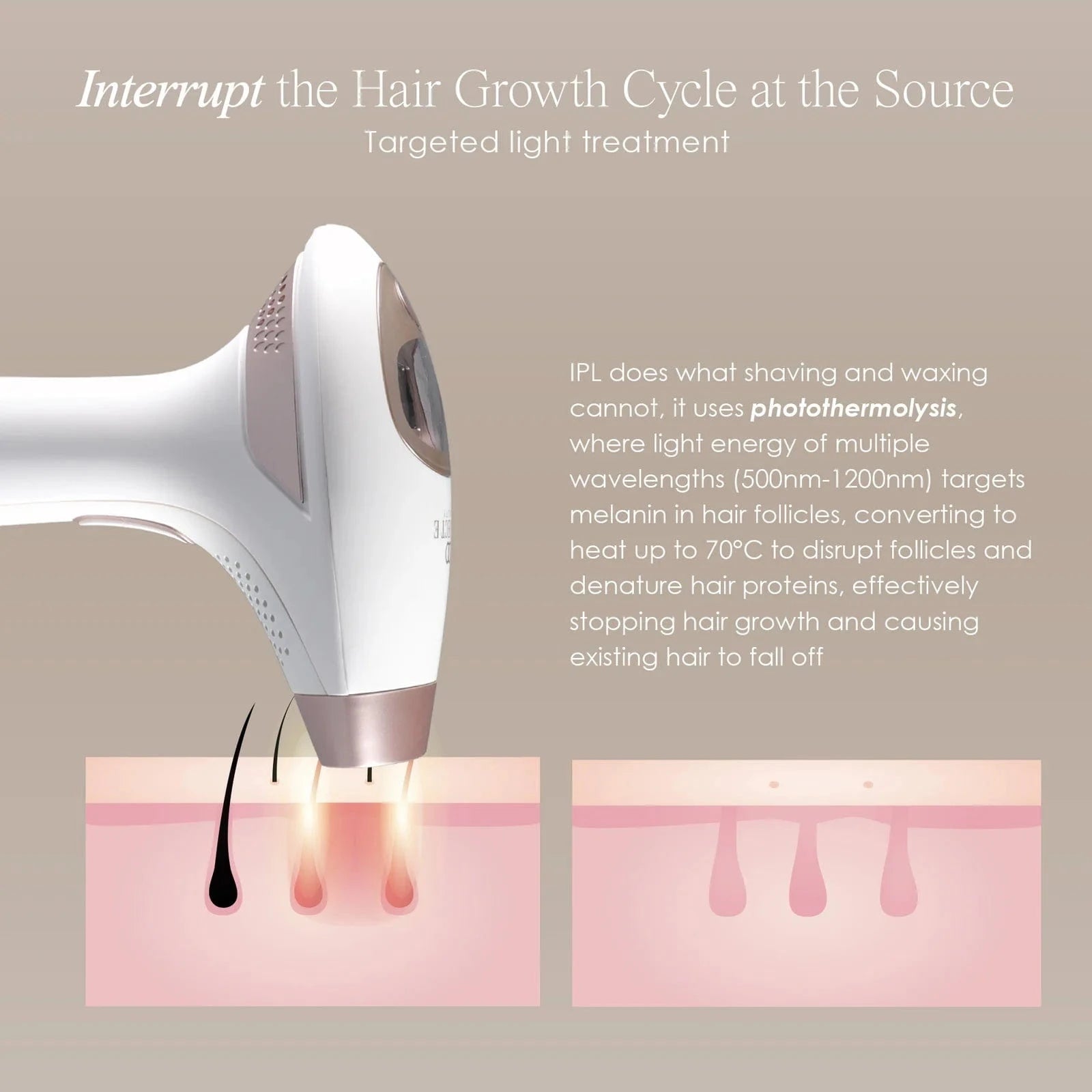Project E Beauty Skin Care SmoothPro+ | IPL Hair Removal Device