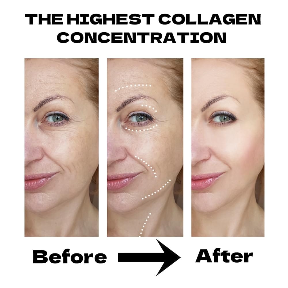 Woman applying Bio Collagen Face Mask for overnight hydration and rejuvenation. Promotes glowing skin with deep moisture and brightening effects.